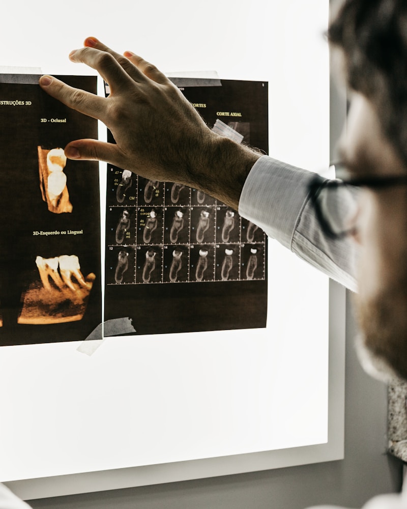 Dentist reviewing an X-ray with a patient